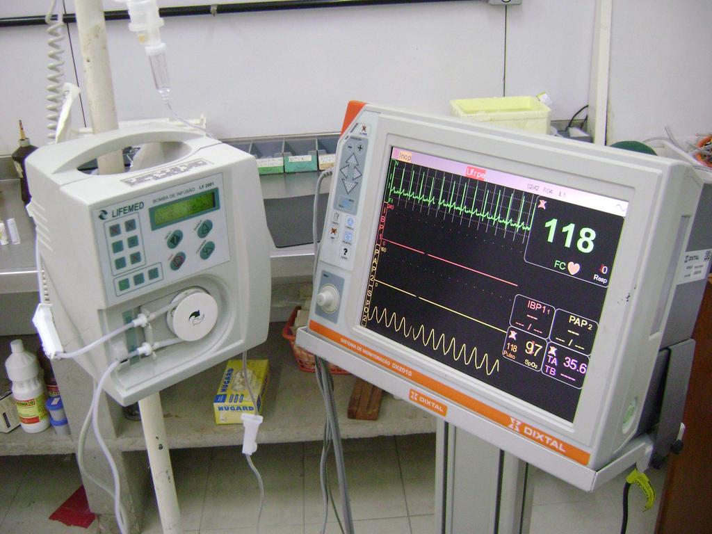 97 PAS (mmhg) s Todos 110 Globo rotacionado; Ausência de tônus mandibular; Ausência de movimentos; Ausência de reflexos ; Ventilação espontanea.