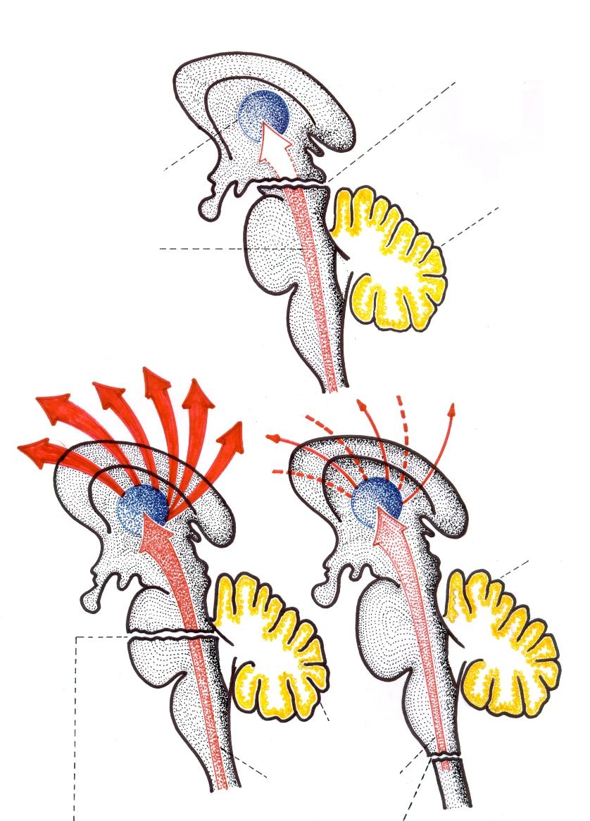 Desenhos esquemáticos das experiências de Bremer em gatos, sobre a Formação Reticular. Córtex cerebral Primeira secção: Intercolicular E.C.G.: Sono contínuo (cérebro isolado).