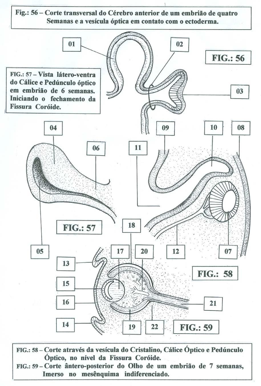 O OLHO E SEU DESENVOLVIMENTO NORMAL. Fig.: 11.3 Corte transversal do Cérebro anterior, de um embrião de quatro semanas e a vesícula óptica, em contato com o ectoderma Fig 11.
