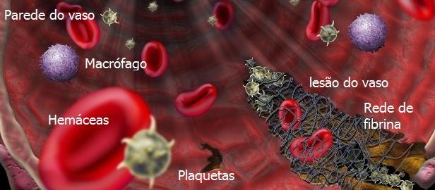 HEMOSTASIA- Cascata da coagulação VIA INTRÍNSECA VIA EXTRÍNSECA