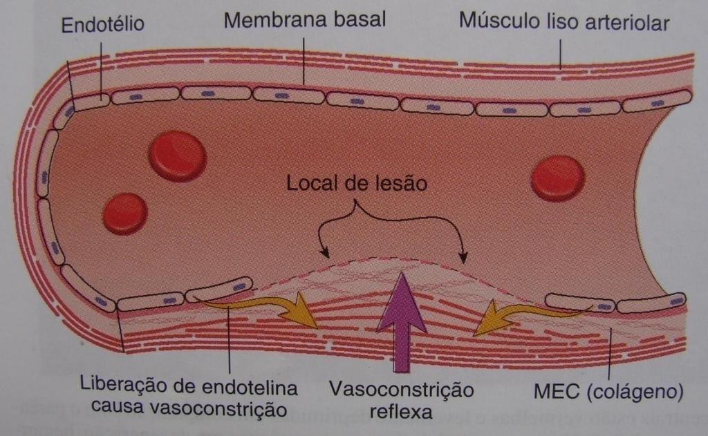 Alteração no calibre vascular mecanismo neurogênico reflexo + liberação de endotelinas