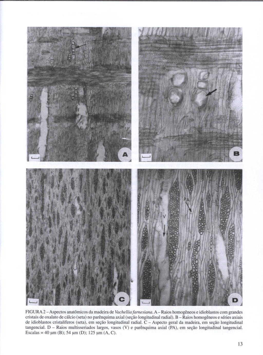FIGURA 2 - Aspectos anatômicos da madeira de Vachelliafarnesiana. A - Raios homogêneos e idioblastos com grandes cristais de oxalato de cálcio (seta) no parênquima axial (seção longitudinal radial).