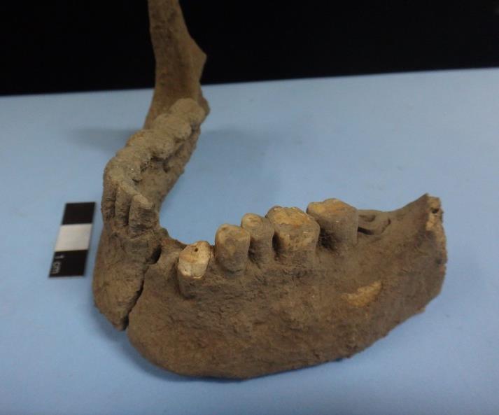 Observou-se uma coloração avermelhadas em alguns ossos e dente, porém, não é possível inferir se é resultado de processos naturais ou ações antrópicas.