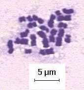 Figura 4: Typhlomyrmex n. sp.