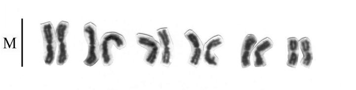 1). A morfologia particular desses cromossomos e da coloração dos núcleos pode ser explicada pela riqueza de heterocromatina, provocando um crescimento anormal de um dos braços dos cromossomos.