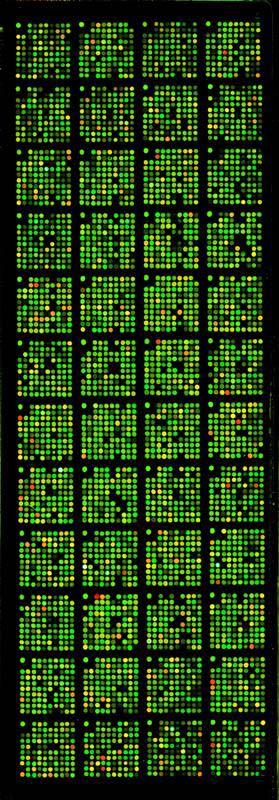 57 Figura 5 - cdna microarrays após digitalização das imagens: composite das lâminas ILPC-4.