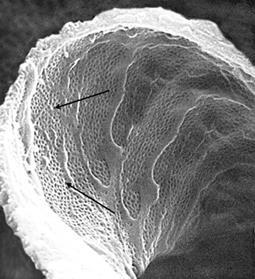 glomerulares Têm múltiplos poros com 70-100 nm de