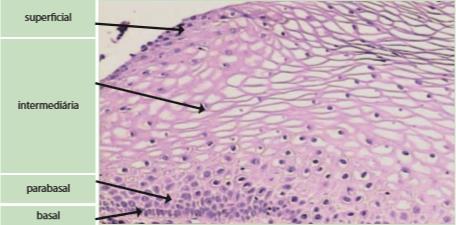 21 5 CARACTERÍSTICAS CITOLÓGICAS DO ESFREGAÇO NORMAL Os epitélios comumente representados no esfregaço cervicovaginal normal são aqueles que constituem a ectocérvice, a endocérvice e o endométrio.