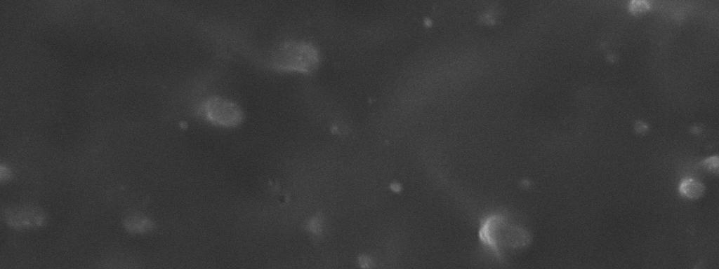 a) b) Figura 3: Micrografias dos filmes obtidos por MEV: a)nrpc/15phrgptms/bf3 ; b)nrpc/dcp1%/15phrgptms/bf3. Aumento de 2000x.