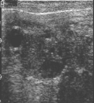 foram monitorados para acompanhamento da dinâmica folicular, aqueles menores que 5 mm foram observados e algumas imagens gravadas no próprio aparelho de ultrassom (Figura 6 e 7).