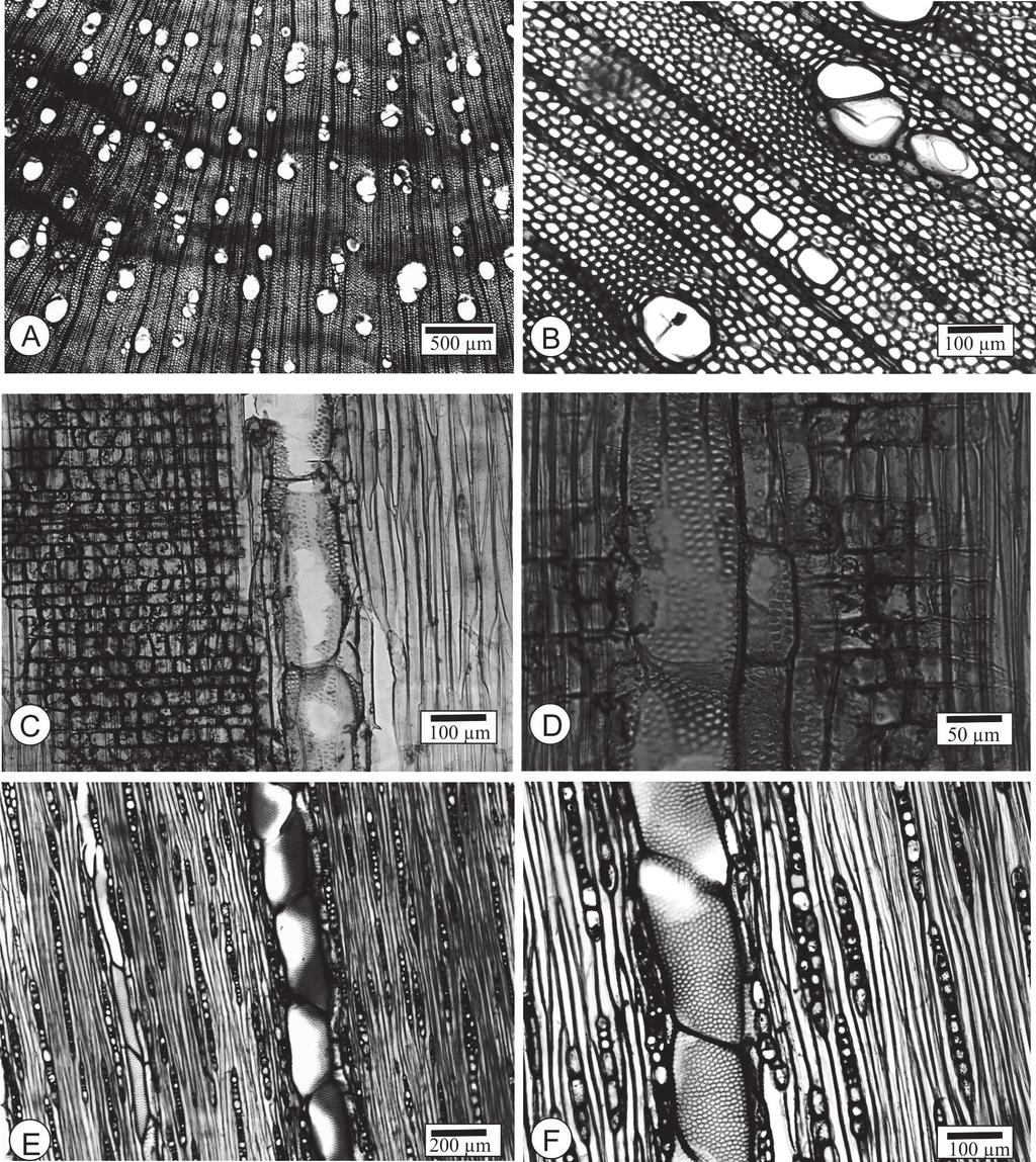 FIGURA 1 Detalhes anatômicos do lenho de Mimosa pigra L. A, B Anéis de crescimento indistintos, porosidade difusa e em múltiplos de poucas unidades (seção transversal).