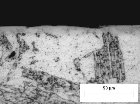 11 Micrografia da condição N763 2.