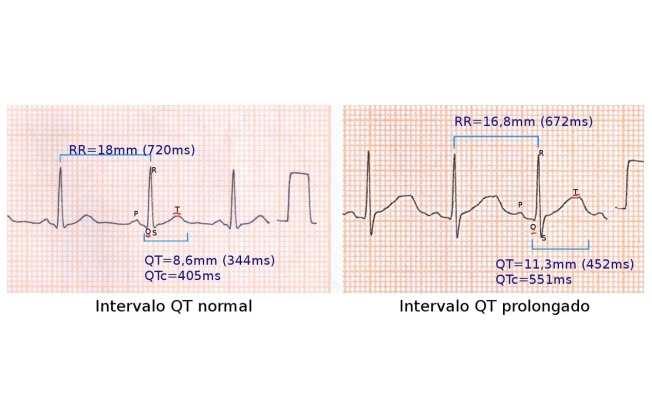 Avaliando O ECG de pacientes.