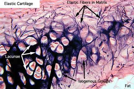 CARTILAGEM ELÁSTICA Cartilagem elástica: Colágeno tipo II + proteoglicanos + fibras elásticas Orelha externa,