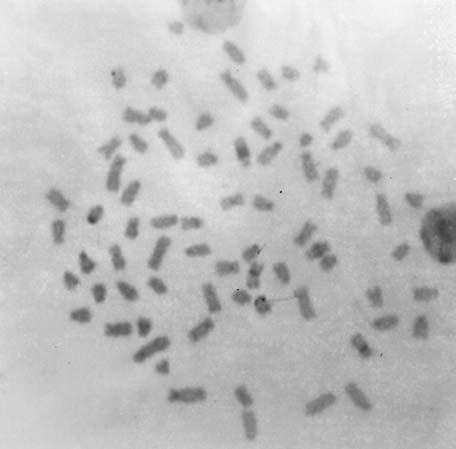 cromossômicos marcados com Nitrato de Prata.