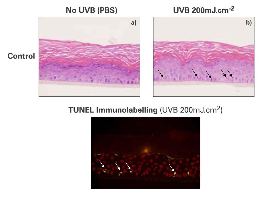 Estudo de Fotoproteção UVA e UVB Um modelo in vitro de epiderme humana reconstituída (EHR) que apresentam altas homologias histo-morfológico comparadas com epiderme normal, foram utilizadas para a