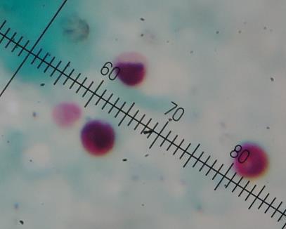 Figura 3- Oocistos de Cryptosporidium sp. detectados em esfregaço fecal corado pela técnica de Ziehl Neelsen modificada. (Ampliação de 1000x). (Fotografia original).