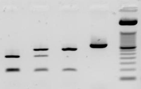 56 Figura 10: Imagem ilustrativa do gel de agarose a 2% para identificação dos polimorfismos FY*01/FY*02 200 150 100 50 392pb 306pb 210pb 86-96pb 1 2 3 4 5 Coluna 1: Marcador de tamanho molecular de