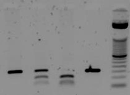 57 Figura 12: Imagem ilustrativa do gel de agarose a 2% para identificação do polimorfismo KEL*01.