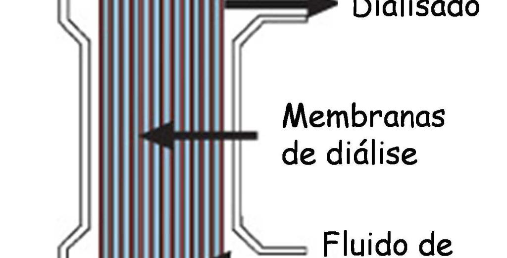 ) do sangue, utilizando um hemodialisador constituído por membranas de fibras ocas (ver figura).