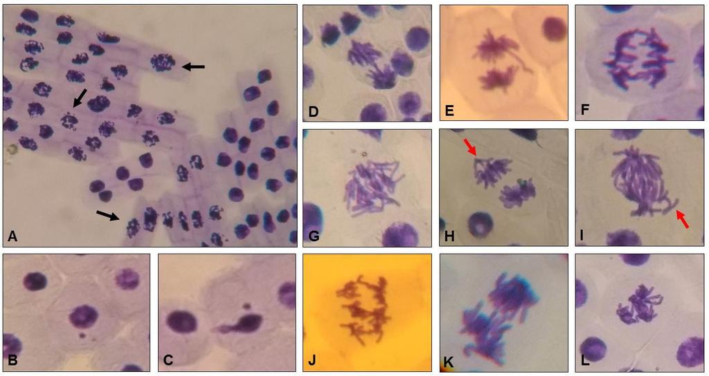 Figura 2 - Micrografias das células meristemáticas de Allium cepa em (A) processo de apoptose indicadas pela seta negra, (B e C) com micronúcleos, e alterações cromossômicas do tipo: (D, E e F)