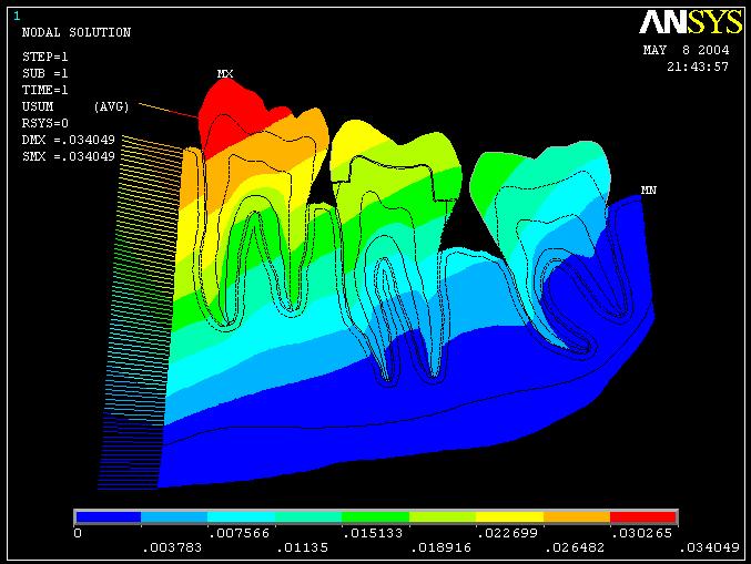 56 4.1. Deflexões O software de elementos finitos Ansys 7.0 oferece a possibilidade de visualizar e extrair dados referentes às deflexões sofridas pelos modelos.