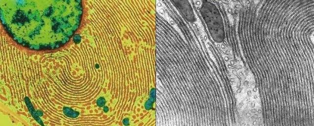 O retículo endoplasmático pode ser subdividido em: Retículo endoplasmático não