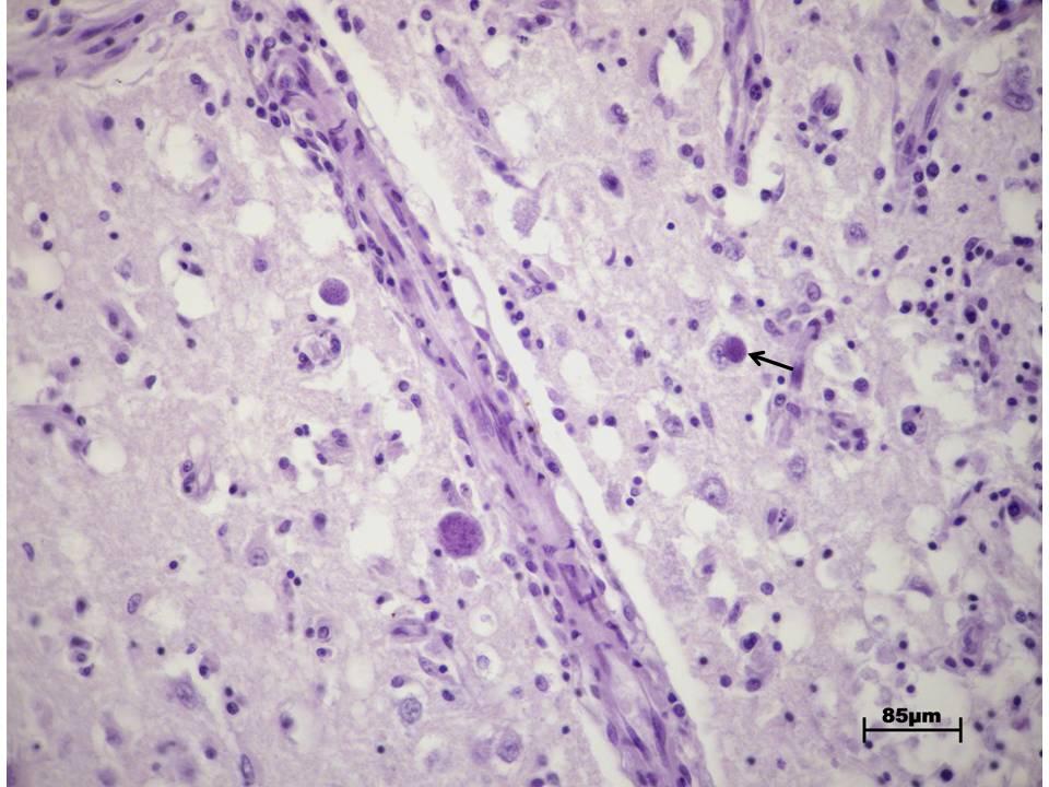 20x Figura 4 Córtex cerebral de cão (animal D) evidenciando cistos basofílicos de