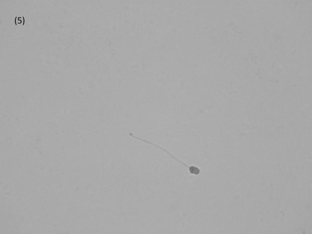 1555 Figure 1. Normal sperm and sperm with primary and secondary anomalies (optical microscopy, 1600x magnification).