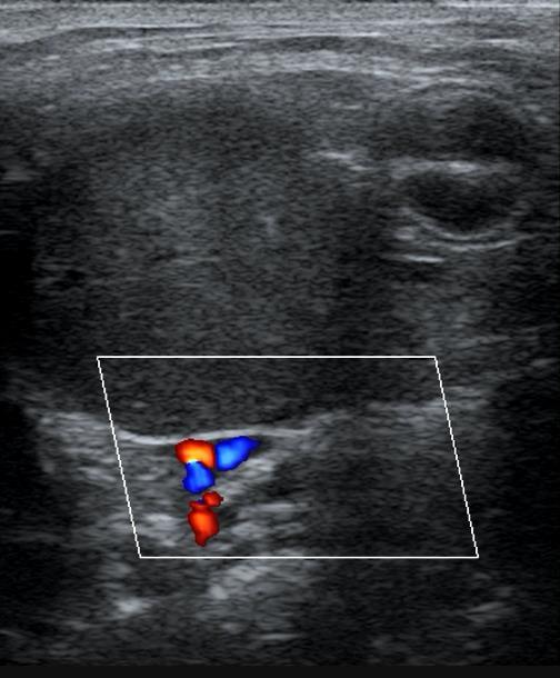 Página 7 FIGURAS Figura 1. Ultrassonografia abdominal do dia 16/07/15.