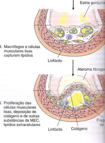 proliferativa Cecill, Tratado