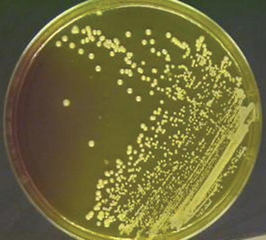 14 O meio de cultura em ágar manitol sal é utilizado para a detecção de Staphylococcus aureus, observado na figura 4.