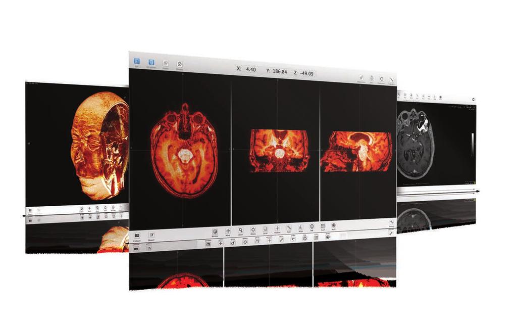 Especialmente desenvolvido para atender as necessidades do neurocirurgião, o Aimplan possui uma interface de fácil navegação e interação.