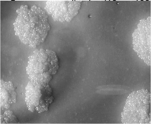 Bacteriologia Amostras Expectoração Secreções brônquicas LBA Suco gástrico Urina Sangue LCR Líquidos serosos Material biópsia Exame directo -Fácil execução e rápido (24h) -Baixa sensibilidade (10 4