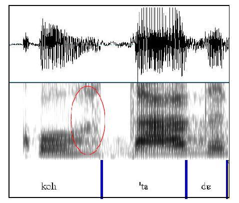 225 Figura 12: Onda sonora, espectrograma, segmentação silábica e transcrição de cortada, em que o fonema /R/ se realiza como fricativo (o destaque em vermelho mostra o ruído gerado pela fricção).