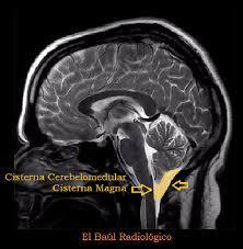 convexidades cerebrais e