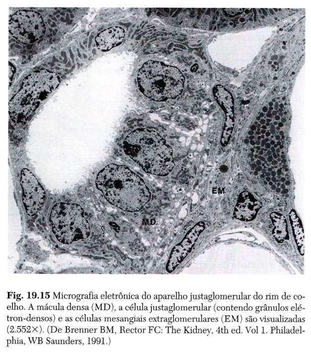 MD Aparelho justaglomerular: 1.