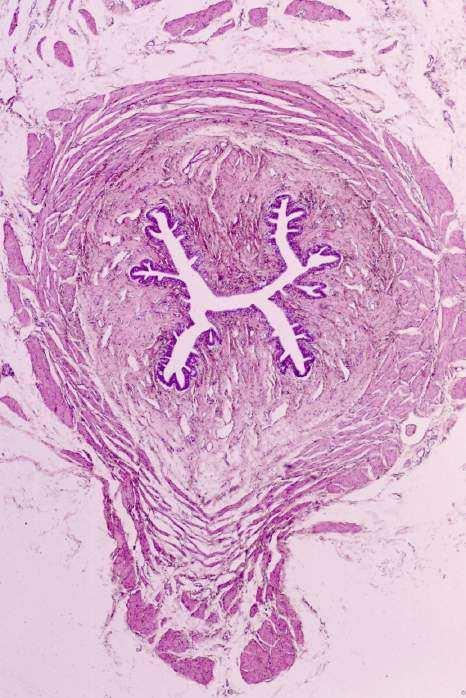 Uretra feminina: Tubo revestido por epitélio estratificado pavimentoso c/ áreas de pseudoestratificado colunar; Próximo à saída esfíncter externo da uretra = músculo estriado.