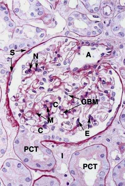 Entre os tufos de capilares originados da arteríola glomerular aferente células mesangiais