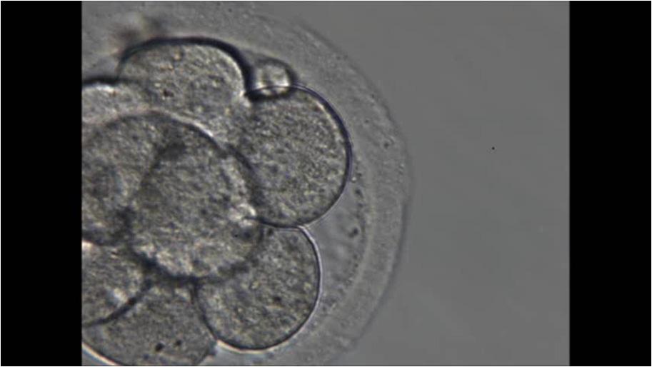 BIÓPSIA EM ESTÁGIO DE CLIVAGEM Laser Normalmente no terceiro dia 75% das biopsia Melhor padronização Maior facilidade para o embriologista No mínimo seis blatômeros Abertura da Zona Pelúcida