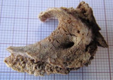 6.6.6. Deformação Foram encontradas deformações em três peças ósseas, um úmero (figuras 68 e 69, p.66), uma tíbia (figura 84, p. 70) e um crânio (figura 94, p.
