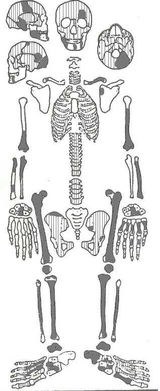 Contexto funerário Ficha de campo- sepultura: covacho; inumação: deposição em decúbito ventral, com orientação norte-sul. Diagnose sexual (Ferembach et al.