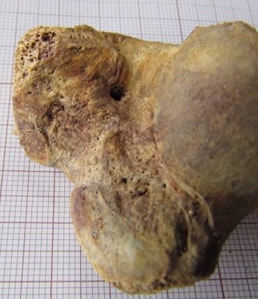 Figura 52- Tíbia esquerda, em norma posterior, evidenciando osso lamelar.