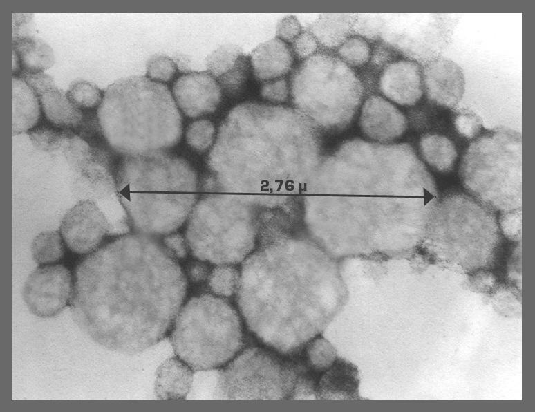 3 - Eletromicrografia de transmissão da NPT básica, adulto 20% HC; T = 72h, (50.000 X). FIG.