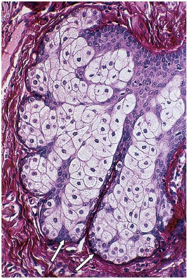 Glândula Sebácea Glândula acinosa ramificada simples.