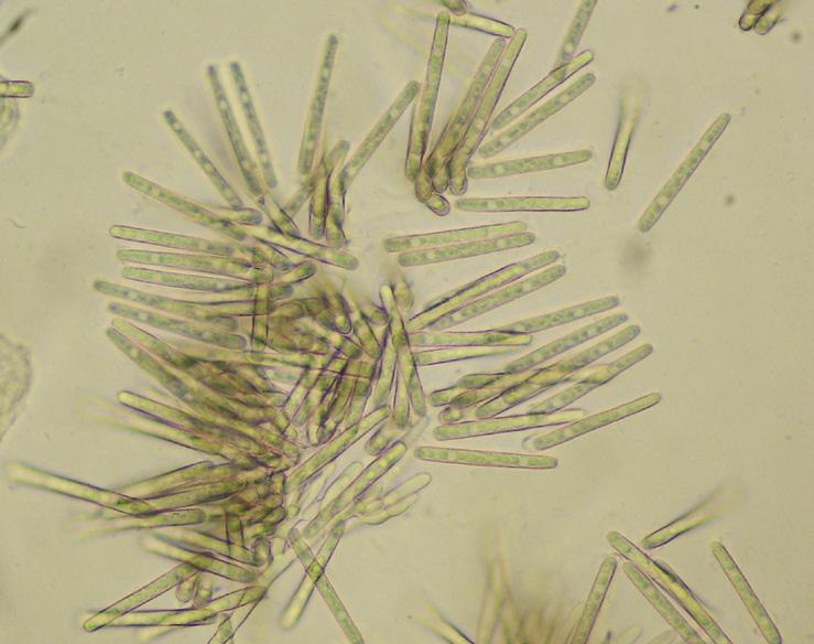 Fusarium solani, F. avenaceum, F. solani f. sp. eumartii e F. oxysporum f. sp. tuberosi.