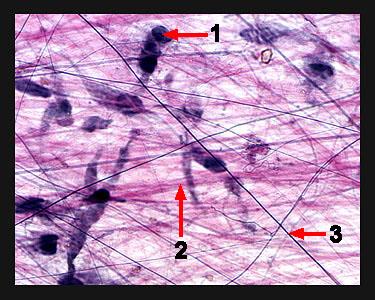 Fibras Elásticas amarelas a fresco cedem ao estiramento Menos produzida em adultos Fibroblasto (pele, tendões) Célula muscular lisa (grandes vasos