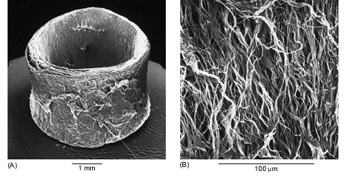 Elastina Segmento da aorta de um cachorro Fibras Elásticas (mesmo tecido) Abundante em tecidos que requerem força elástica (pele, vasos sg.