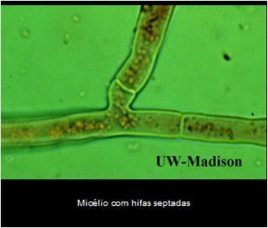 FUNGOS FILAMENTOSOS: