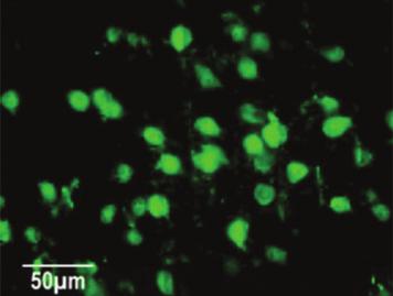 pré-tratadas com promove a neurogénese e a neuroplasticidade Aumenta o